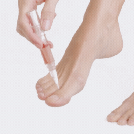 onyvia.® - Stylo Sérum Mycose des ongles